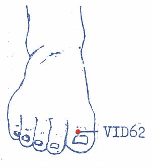 vi-d62.jpg vi-d62.jpg
