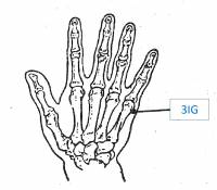 3ig-a.jpg