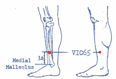 vi-c65.jpg vi-c65.jpg